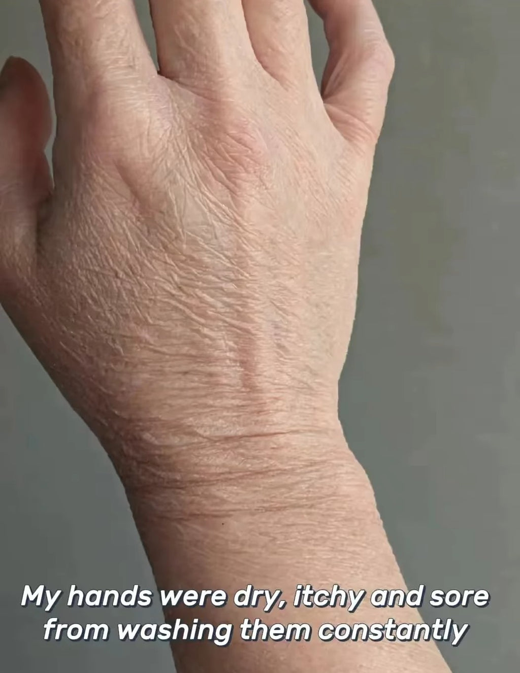 VEGAN TALLOW BALM - MOISTURE SEALANT/SKIN BARRIER -SOFT/LIGHTWEIGHT