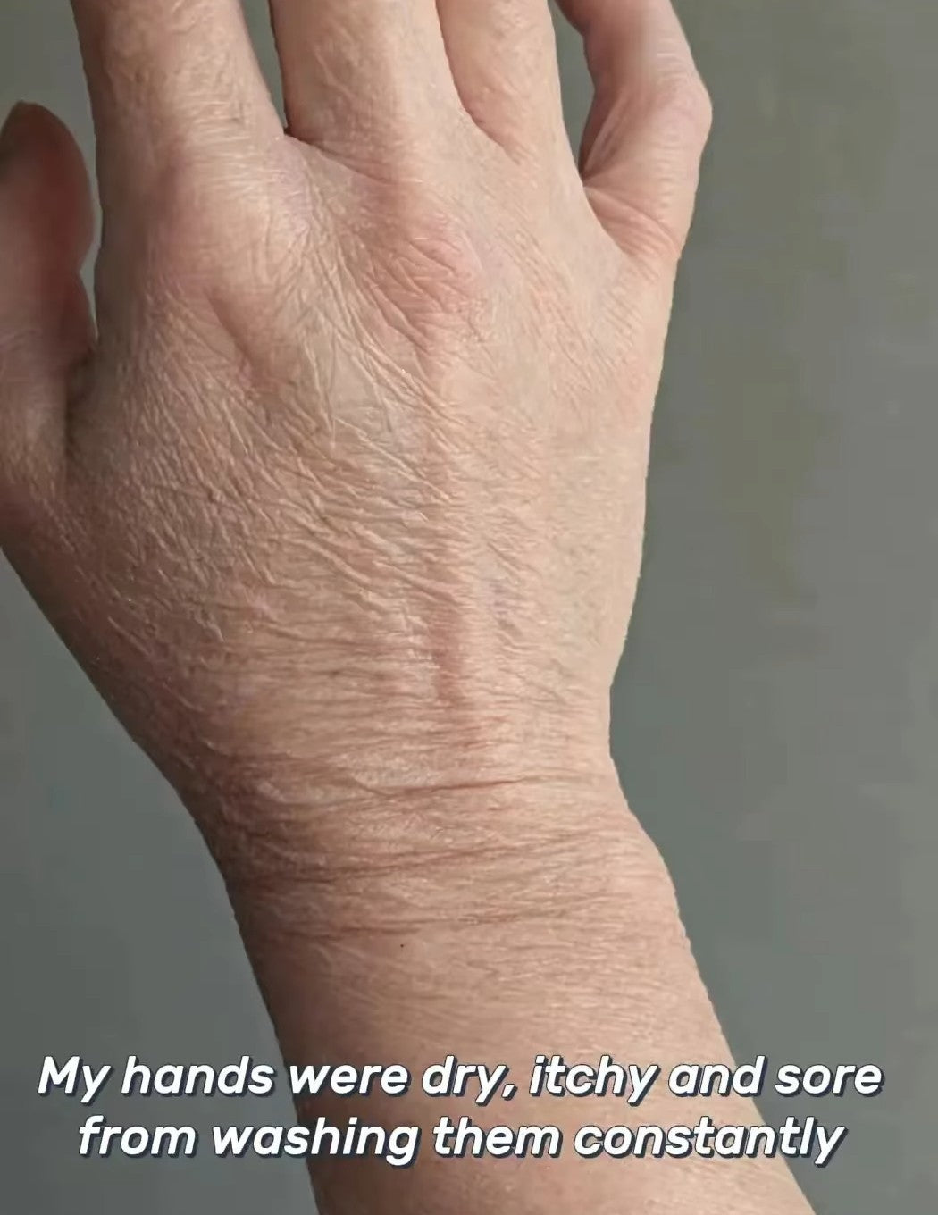 VEGAN TALLOW BALM - MOISTURE SEALANT/SKIN BARRIER -SOFT/LIGHTWEIGHT